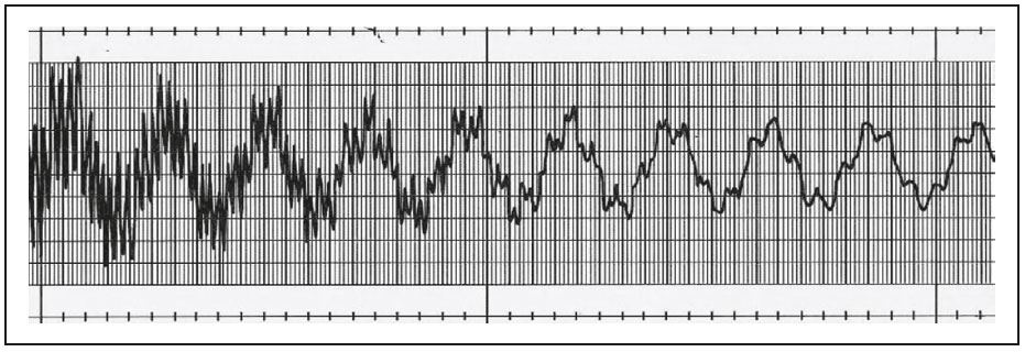 Data readout of Free Vibration With Standard Arm