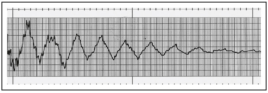 Data readout of Free Vibration With Hapco’s Vibration Isolating Arm